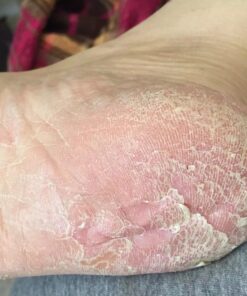 Plant Therapy Organic Tea Tree Oil (Melaleuca) 100% Pure, USDA Certified Organic, Undiluted, Natural Aromatherapy, Therapeutic Grade 10 mL (1/3 oz) 19 71aw1bqxOkL