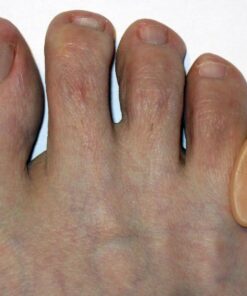 ZenToes Gel Toe Separators for Overlapping Toes, Bunions, Big Toe Alignment, Corrector and Spacer - 4 Pack (Beige) Beige 34 71blNa8iAOL
