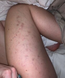 Coolife Fascia Muscle Roller - Cellulite Massager - Fascia Roller for Cellulite and Sore Muscles - Neck, Leg, Back, Body Roller Deep Tissue Massage Stick Tools - 3 Balls Size Version. Mint Green 39 71bxXmG28yL