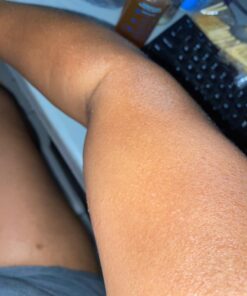 Terrasil Skin Repair Cream MAX, Natural Ingredients, Zinc Oxide Ointment for Folliculitis and Boil Symptoms, All Purpose First Aid Supplies, Anti Itch Cream, 50g 17 71clkDx3roL