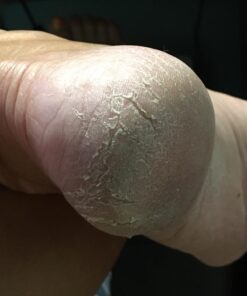 Amope Pedi Perfect Electronic Foot File, Dual-Speed Callus Remover (with Diamond Crystals) for Feet (Extra Coarse - Pink Gadget). -Perfect for In-home Pedicure for Baby Smooth Feet. Battery Operated 45 71cvB0AxegL