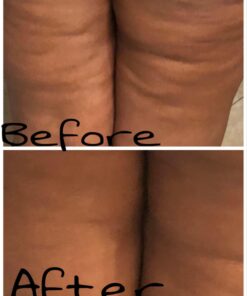 Anti Cellulite Vacuum 2 Cups Set Medical Silicone with Cellulite Massager Remover and Exfoliating Facial Brush for Perfect Body 29 71dAoK1AgPL