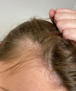 DrFormulas HairOmega DHT Blocker Biotin 5000 mcg Vitamins for Hair Growth Supplement | Hair Loss Pills for Women and Men, 30 Day Supply 60 Count (Pack of 1) 26 71dBR3ai2L