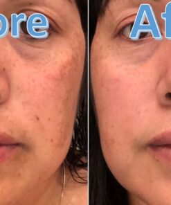 Dark Spot Corrector Face Moisturizer with SPF 30 for Even Skin Tone by L’Oreal Paris, Youth Code Anti-Aging Day Cream, Non-greasy, 1.7 oz. 1.7 Ounce (Pack of 1) 25 71dCuer3O2L