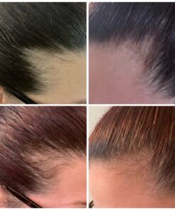 vitafusion Extra Strength Biotin Gummy Vitamins, Berry Flavored, 5,000 mcg Biotin Vitamins, America’s Number 1 Gummy Vitamin Brand, 50 Day Supply, 100 Count (Packaging may vary) 51 71dt4ZwoAaL