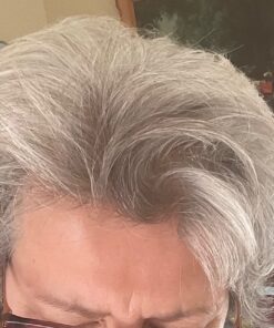 PURA D'OR Professional Grade Biotin Anti-Hair Thinning Shampoo & Conditioner, CLINICALLY TESTED Proven Results, 2X Concentrated DHT Blocker Thickening Products For Women & Men, Sulfate Free, 16oz x 2 31 71edpgV7XRL