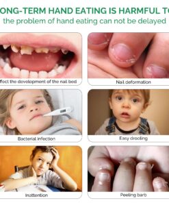 Nail Biting Treatment for Kids, Natural Thumb Sucking Stop for Kids Effective Prevent Kids Sucking Thumb and Biting Nail, No Biting Nail Polish Original 9 71epUyJeqbL
