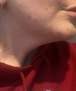 Terrasil Wound Care - 3X Faster Healing, Infection Protection Ointment for bed sores, pressure sores, diabetic wounds, ulcers, cuts, scrapes, and burns (14 gram tube) 47 71erSW90aBL