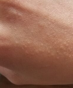 Teliaoils Lemon Balm Salve, Fast Acting/Natural Salve. Cold Sores - Skin Rashes - Irritated Skin - Itchy Skin. (1.7 Oz / 50 Ml) 1.76 Ounce (Pack of 1) 34 71f2 MbbqKL