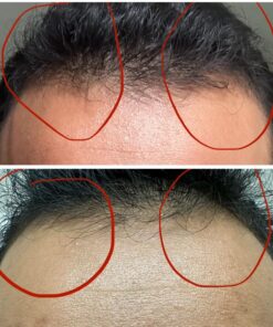 Nature's Bounty Biotin, Supports Healthy Hair, Skin and Nails, 10,000 mcg, Rapid Release Softgels, 120 Ct Unflavored 120 Count (Pack of 1) 28 71f8YbZzwZL