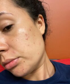 Alani Nu Balance | Supplement for Women | Hormonal Support | Weight Management and Clear Complexion | Gluten Free | Vegan | Sugar Free | 120 Veggie Capsules | 30 Day Supply Unflavored 47 71fB9CXDaSL