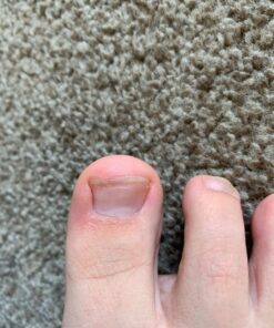 PURELY NORTHWEST-Tea Tree Oil & Peppermint Foot Soak with Epsom Salt-for Stubborn Foot Odor, Athletes Foot Burning & Itching, Damaged Discolored Nails-A Natural Callus Remover 16 Ounces 1 Pound (Pack of 1) 35 71fFCRUH6KL