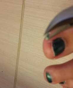 Fox Medical Equipment Toenail Clippers - Professional Nail Clippers for Thick and Ingrown Nails - Precision Toenail Clipper - Best Nippers for Thick Toenails - Stainless Steel Soft Grip Nail Clipper 31 71fiueiMl7L