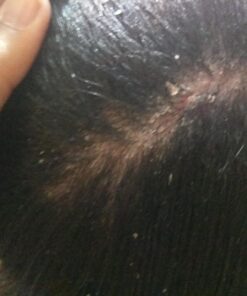 Tea Tree Shampoo and Conditioner Set - Sulfate Free Clarifying Shampoo and Conditioner for Oily Hair & Scalp Care with Australian Tea Tree Oil - Complete Dry Scalp Treatment for Build Up (8 Fl Oz) 8 Fl Oz (Pack of 2) 38 71fo8zSScBL