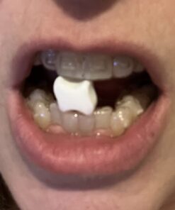 Movemints Clear Aligner Mints - Patented Aligner Seating Mints - Edible Alternative to Aligner Chewies - Xylitol Mints for Dry Mouth - Spearmint Flavor (3 Pack) 20 Count (Pack of 3) 14 71g4zW fN3L