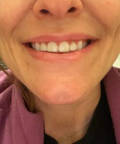 PHILIPS Zoom Nite White 22% 3 Syringes 20 71gWQS vzVL