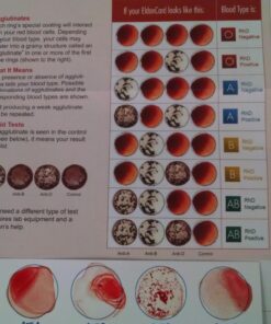 Eldoncard Blood Typing Kit, 3 Tests, Know Your Blood Type, Instant Home Testing Kit, A, O, B, Rhs-D Negative and Positive Blood Types Tested For 37 71gbb22gL