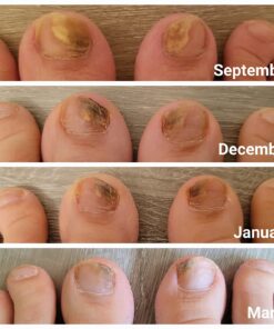 NutriBiotic – GSE, 2 Oz Liquid | The Original Grapefruit Seed Extract Premium Concentrate with Bioflavonoids | Potent Immune & Overall Health Support | Vegan, Gluten Free, Non-GMO 18 71gddd9llL