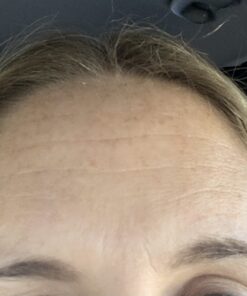Frownies Forehead and Between Eyes Wrinkle Patches The Original Wrinkle Patch Non Invasive Wrinkle Smoothers for Forehead Wrinkles 35 71gkdZQxjdL