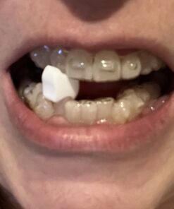 Movemints Clear Aligner Mints - Patented Aligner Seating Mints - Edible Alternative to Aligner Chewies - Xylitol Mints for Dry Mouth - Spearmint Flavor (3 Pack) 20 Count (Pack of 3) 13 71gw9jeJbL