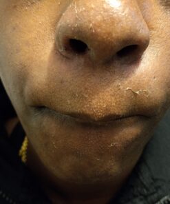 Glycolic Acid 50% Gel Peel with Chamomile and Green Tea Extracts - Professional Grade Chemical Face Peel for Acne Blemishes, Collagen Boost, Wrinkles, Fine Lines - Alpha Hydroxy Acid - 1 Bottle of 1 fl oz 37 71gxUkNhXZL