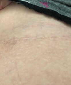 Mepitac 298400 Soft Silicone Tape, 1-1/2" x 59" 13 71i0kFzSqLL