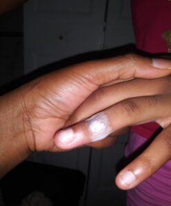 Compound W One Step Wart Remover Strips for Kids, 10 Medicated Strips for Wart Removal, 2 Pack unflavored 10 Count (Pack of 2) 54 71iKbOr6GUL