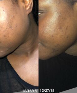 Black Soap 12 Bar Value Pack By Dudu Osun For African American Skin Care Each Soap Bar Contains Shea Butter 45 71iZLRm VYL