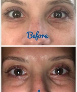 Eye Zone Lifting Massager NEW SPA Microcurrent Kit 11 71iaDxn9F L