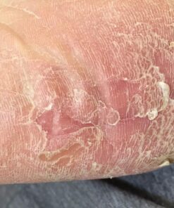 Plant Therapy Organic Tea Tree Oil (Melaleuca) 100% Pure, USDA Certified Organic, Undiluted, Natural Aromatherapy, Therapeutic Grade 10 mL (1/3 oz) 20 71id1xQAG9L