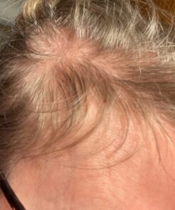 BeLive Biotin Gummies with MultiVitamins, Folate, Inositol – Supports Hair Growth, Healthy Skin & Nails – Vegan, Pectin Based – Strawberry Flavor (1) 60 Count (Pack of 1) 37 71jCyLFjUwL