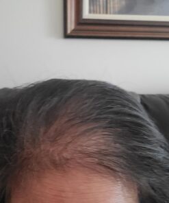 Men's Rogaine 5% Minoxidil Foam for Hair Loss and Hair Regrowth, Topical Treatment for Thinning Hair, 3-Month Supply, 2.11 Ounce (Pack of 3) Men's Rogaine Foam Treatment (3-Month Supply) 2.11 Ounce (Pack of 3) 54 71jEngRyexL