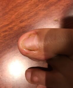 NZ Country Manuka Oil | 100% Pure Organic Essential Oil | Natural and Effective Skin Care | Plant Therapy Essential Oils for Body, Nails, Hair, Skin & Lips | 35x Stronger Than Organic Tea Tree Oil 43 71jJ r7isL