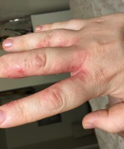 MIZON Snail Line Gift Set, Skincare Set, Set of Two Snail Recovery Gel Cream, Wrinkle Care, Skin Elasticity, Moisture, Fragrance-Free, Paraben-Free (45ml 1.52 fl.oz -Pack of 2) 2 Count (Pack of 1) 46 71jOAegFntL