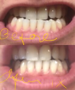 Active Wow Activated Coconut Charcoal Powder - Natural Whitening Activated Charcoal, Charcoal Vanilla Toothpaste, Fluoride Free, Sulfate & Paraben Free, Charcoal Toothpaste Powder (All Natural) All Natural 39 71jXTR4TcSL