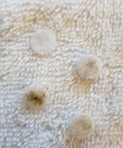 Kendal Professional Diamond Microdermabrasion Machine, Dermabrasion Facial Skin Care Equipment, Also Good for Home Use AC 110V HB-SF01 48 71jyadD6VTL