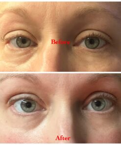 DERMORA Golden Glow Under Eye Patches (20 Pairs Eye Gels) - Rejuvenating Treatment for Dark Circles, Puffy Eyes, Refreshing, Revitalizing, Travel, Wrinkles 20 Count (Pack of 1) 28 71kCCT6GoSL