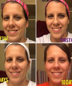 L'Oréal Paris Revitalift Bright Reveal Anti-Aging Exfoliating Peel Pads with Glycolic Acid, Reduce Wrinkles & Brighten Skin, 30 Count (Pack of 1) 40 71kNTsSs8dL