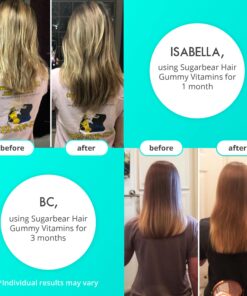 Sugarbear Hair Vegan Vitamin Gummies for Luscious Hair with Biotin, Vitamin C, B12, Folic Acid, Inositol, Coconut Oil - Hair and Nails Supplement for Women & Men (3 Month Gift Pack Free Brush) 60 Count (Pack of 3) 32 71kXjxZdo0L 1