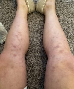 Coolife Fascia Muscle Roller - Cellulite Massager - Fascia Roller for Cellulite and Sore Muscles - Neck, Leg, Back, Body Roller Deep Tissue Massage Stick Tools - 3 Balls Size Version. Mint Green 34 71kaZYcaLCL