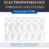 Essential Concepts of Electrophysiology through Case Studies: Intracardiac EGMs 3 71lBxhUoCLL