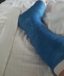 Medline Non-Sterile Tubular Stockinettes, 3" x 25 Yd, 1 Roll 11 71lEqQABp9L