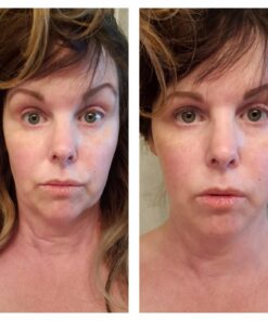 Art Harding's Instant Face & Neck Lift (Dark) - Chemical-Free, Hypoallergenic, for All Skin Types Dark 19 71lF5igPNrL