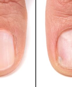 Barielle Fungus Rx 1 ounce 13 71lHDAgmRuL