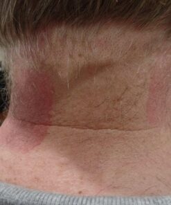 iReliev TENS + EMS Combination Unit Muscle Stimulator for Pain Relief & Arthritis & Muscle Strength - Treats Tired and Sore Muscles in Your Shoulders, Back, Ab's, Legs, Knee's and More 33 71lKQ316S5L