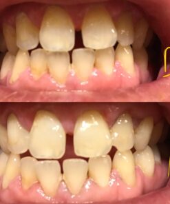 Active Wow Activated Coconut Charcoal Powder - Natural Whitening Activated Charcoal, Charcoal Vanilla Toothpaste, Fluoride Free, Sulfate & Paraben Free, Charcoal Toothpaste Powder (All Natural) All Natural 40 71lx9NuZtYL