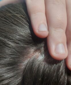 Nizoral Anti-Dandruff Shampoo with 1% Ketoconazole, Fresh Scent, 7 Fl Oz 45 71m10nGfcwL