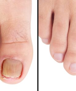 Barielle Fungus Rx 1 ounce 14 71mNN 7yTtL