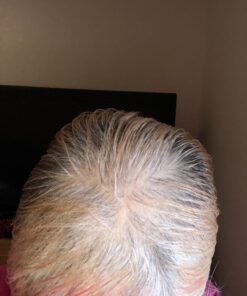 Natrol Biotin Beauty Tablets Promotes Healthy Hair Skin and Nails Helps Support Energy Metabolism Helps Convert Food Into Energy Maximum Strength 10000mcg, Multi, 200 Count 51 71mzduQKBL