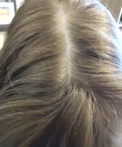 Nizoral Anti-Dandruff Shampoo with 1% Ketoconazole, Fresh Scent, 7 Fl Oz 46 71nEM23PVxL